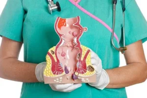 علاج البواسير