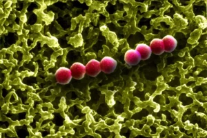 الالتهاب الرئوي Pneumonia