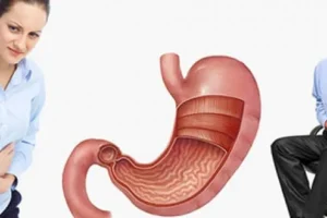 أسباب التهابات المعدة وأعراضها وكيفية علاجها