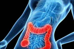 نصائح لمرضى القولون العصبي