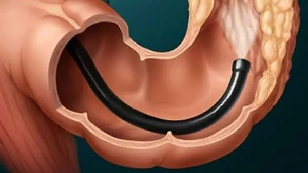 كيفية تنظيف القولون بطرق طبيعية