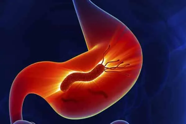 جرثومة المعدة