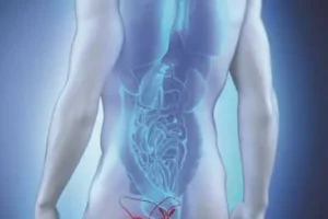 أعراض سرطان البروستاتا وطرق علاجه