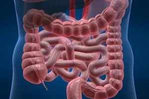 أعراض التهاب القولون التقرحي وعلاجه