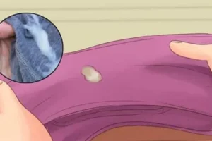 ظهور الإفرازات الخضراء خلال الحمل