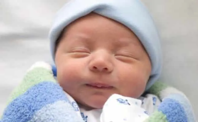 التشوهات الخلقية