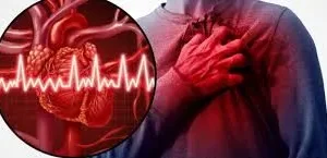 مرض القلب التاجي