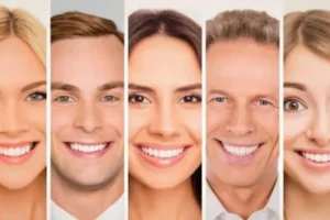 الفرق بين ابتسامة هوليوود والفينير veneer