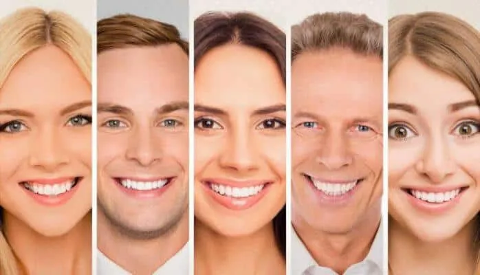 الفرق بين ابتسامة هوليوود والفينير veneer